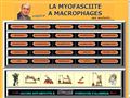 La Myofasciite A Macrophages Ma Maladie ...